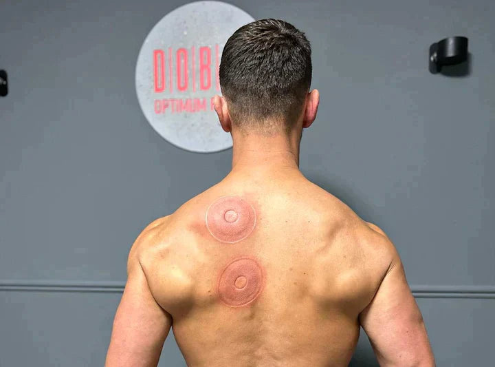 Pro Vacuum Cupping Device